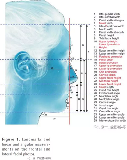 正畸文献阅读--对美貌年轻女性面部尺寸的分析