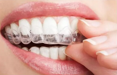 数字化技术应用于口腔正畸治疗的思考