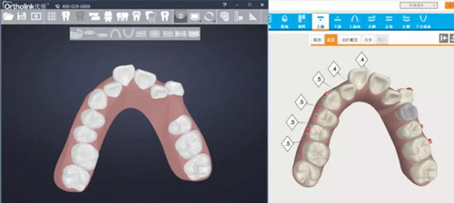 数字化技术应用于口腔正畸治疗的思考