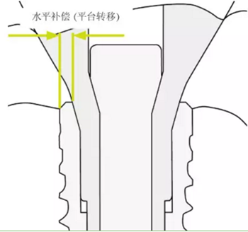 揭秘士卓曼种植体-基台的长期稳定性