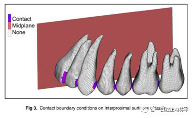 正畸文献阅读--对于滑动法关闭间隙的有限元分析