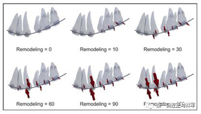 正畸文献阅读--对于滑动法关闭间隙的有限元分析