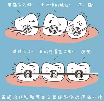 牙齿正畸过程中需注意哪些事项？