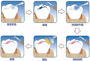 你总嚷着看牙“贵”还不是你自己造成的