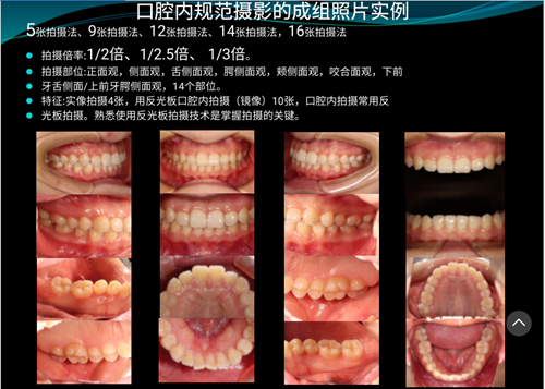 口内照摄影方法与技巧分享