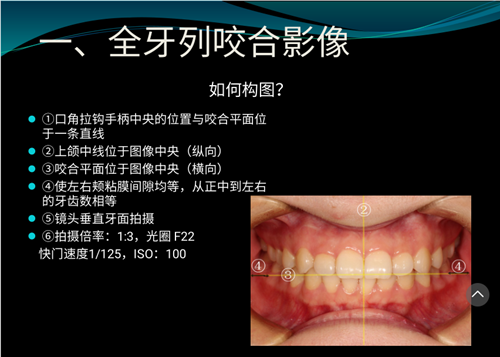 口内照摄影方法与技巧分享