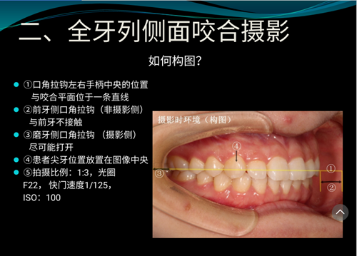 口内照摄影方法与技巧分享