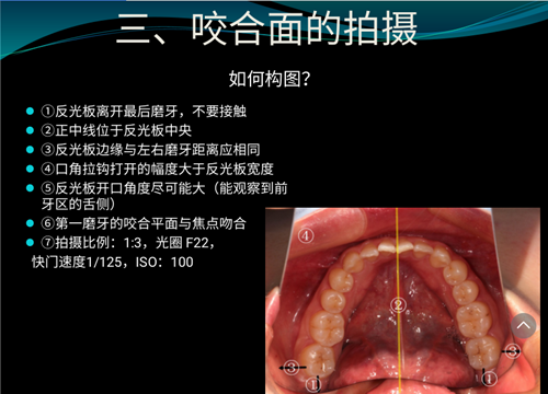 口内照摄影方法与技巧分享