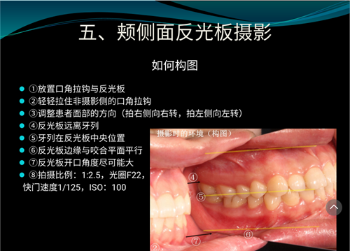 口内照摄影方法与技巧分享