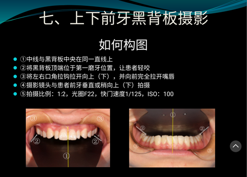 口内照摄影方法与技巧分享