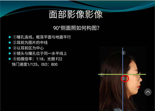 口内照摄影方法与技巧分享