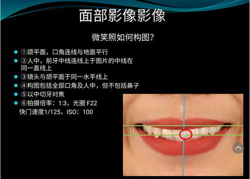 口内照摄影方法与技巧分享