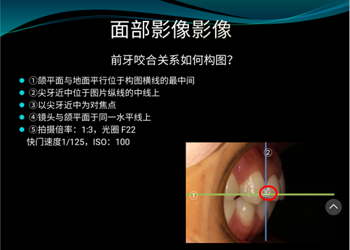 口内照摄影方法与技巧分享