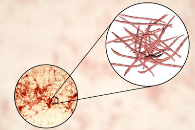 食道癌？胰腺癌？肠道疾病？口腔微生物们做了什么！