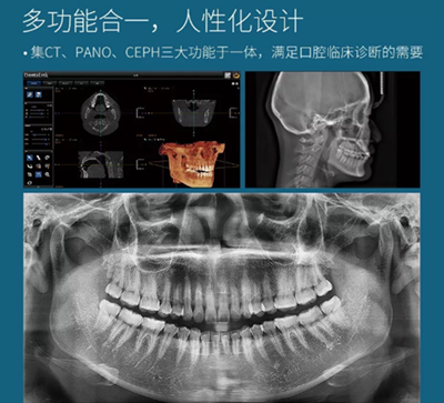 费森影像