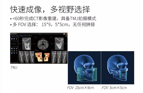 费森影像