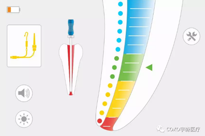 多频技术的根管长度测定仪