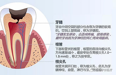 多频技术的根管长度测定仪