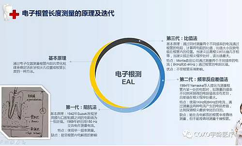 多频技术的根管长度测定仪