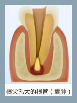 多频技术的根管长度测定仪