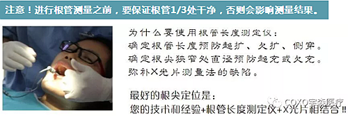 多频技术的根管长度测定仪