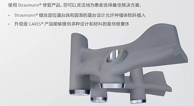 【热点回顾】带您深度了解无牙颌种植修复——Pro Arch