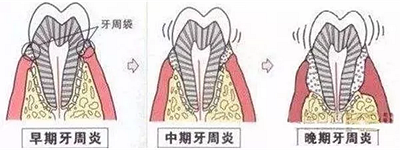 上海嘉福口腔研究所二十一世纪牙周病的临床进展