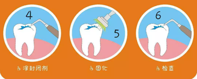 儿童龋病的预防