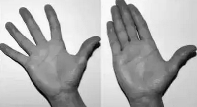 牙医必看！你的双手很重要！