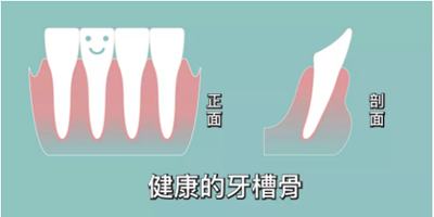 正畸矫正