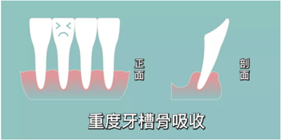 正畸矫正