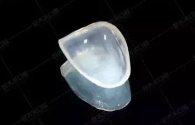 瓷贴面修复体最终颜色的影响因素 瓷贴面修复体最终颜色的影响因素