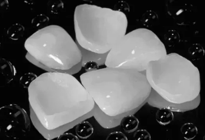 瓷贴面修复体最终颜色的影响因素 瓷贴面修复体最终颜色的影响因素