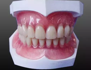 如何做好全口义齿? 如何做好全口义齿?