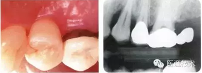 【牙周外科】牙齿的解剖形态（上篇）