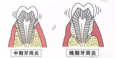 品瑞迈格磁致伸缩治疗仪