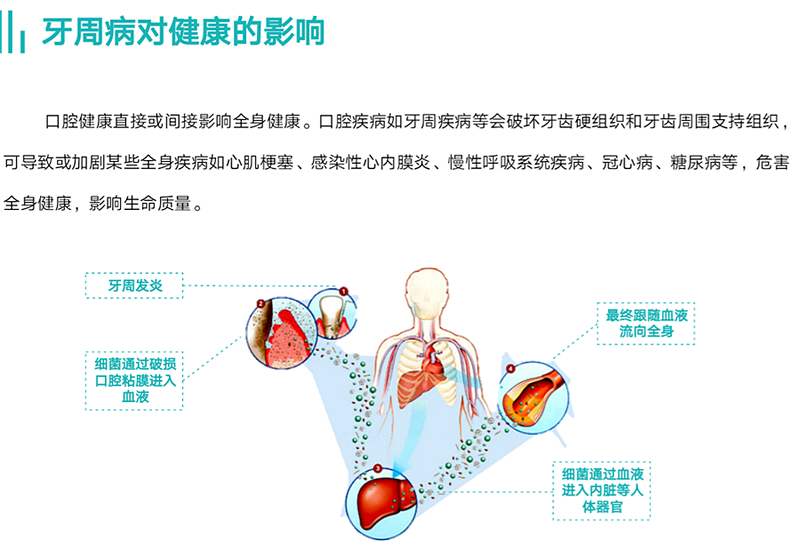 牙周病对健康的影响