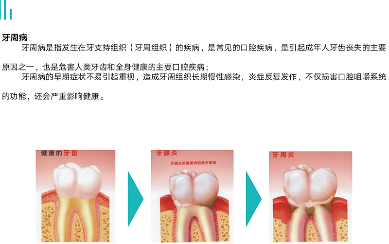牙周病对健康的影响