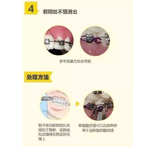 特殊时期为什么常规的口腔治疗都不能做了？