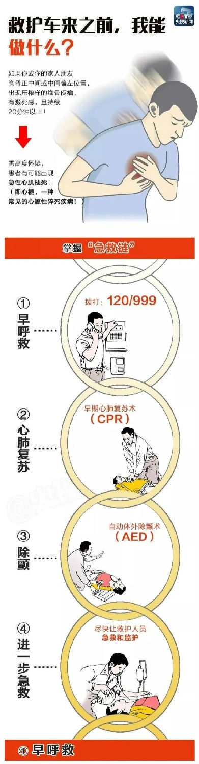 心肺复苏