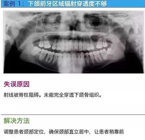 曲断的10大经典失误案例及原因分析！