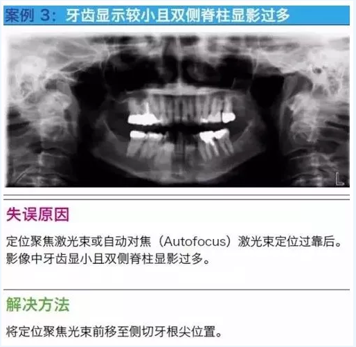 曲断的10大经典失误案例及原因分析！