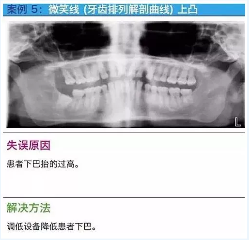 曲断的10大经典失误案例及原因分析！