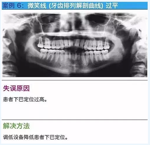 曲断的10大经典失误案例及原因分析！