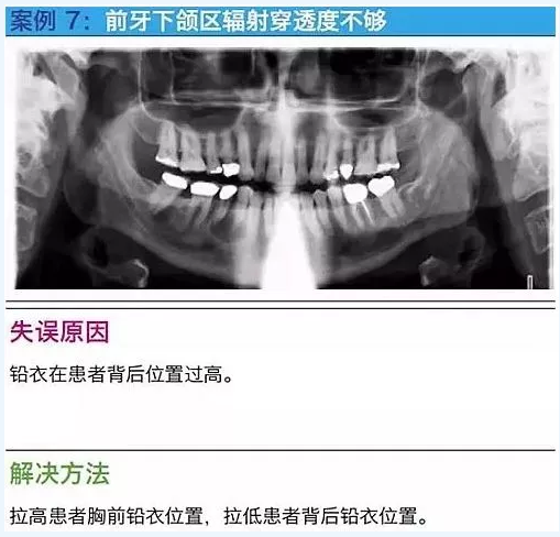 曲断的10大经典失误案例及原因分析！