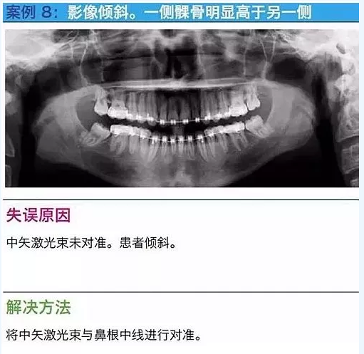 曲断的10大经典失误案例及原因分析！