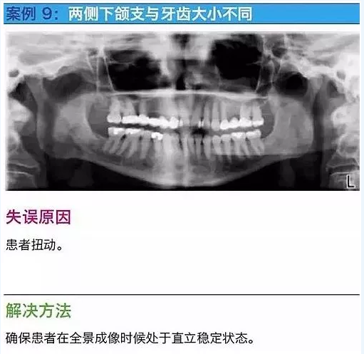 曲断的10大经典失误案例及原因分析！