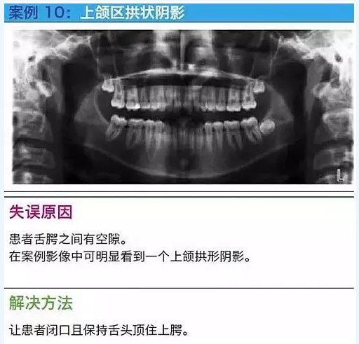 曲断的10大经典失误案例及原因分析！