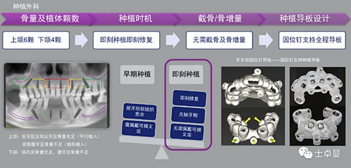 【病例分享】应用全程数字化对牙周炎患者实现全口即刻种植即刻修复
