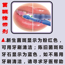 泰丝美“快显”双色菌斑指示剂  批发